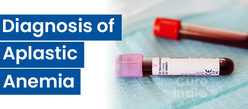 Diagnosis Methods for Aplastic Anemia